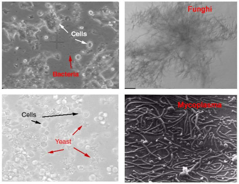 Yeast, bacteria, and fungus are visible with microscopy but mucoplasma not